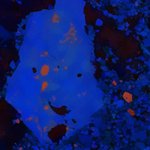 Pustule